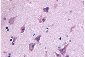Immunohistochemical staining of human brain, neurons and glia with QRFPR polyclonal antibody . (QRFPR Antikörper  (N-Term))