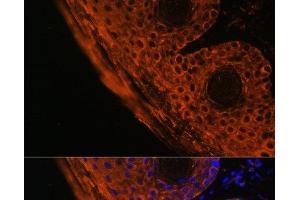 Immunofluorescence analysis of Mouse skin cells using TGM1 Polyclonal Antibody at dilution of 1:100. (TGM1 Antikörper)