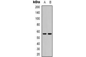 Western blot analysis of CD276 expression in MCF7 (A), HEK293T (B) whole cell lysates. (CD276 Antikörper)