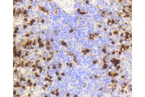 Immunohistochemistry of paraffin-embedded human spleen using LYZ antibody (ABIN5997039) at dilution of 1/100 (40x lens). (LYZ Antikörper)