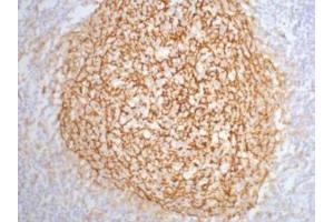 Immunohistochemistry (IHC) image for anti-Complement Component (3d/Epstein Barr Virus) Receptor 2 (CR2) antibody (ABIN3181130) (CD21 Antikörper)