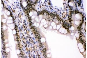 IHC analysis of p95 NBS1 using anti-p95 NBS1 antibody (ABIN3043282). (Nibrin Antikörper  (C-Term))