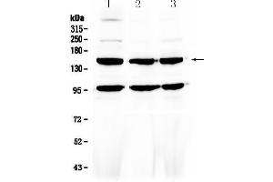 Western blot analysis of VEGF Receptor 3 using anti-VEGF Receptor 3 antibody . (FLT4 Antikörper)