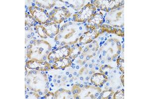 Immunohistochemistry of paraffin-embedded mouse kidney using PEX5 antibody (ABIN6133015, ABIN6145469, ABIN6145471 and ABIN6221464) at dilution of 1:100 (40x lens). (PEX5 Antikörper  (AA 1-260))
