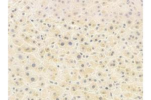 ABIN6259284 and ABIN6273374 at 1/100 staining human normal liver tissue by IHC-P. (PSPC1 Antikörper  (C-Term))