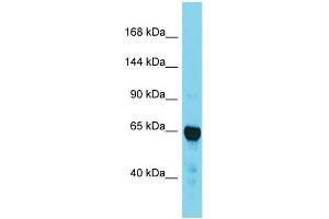 Western Blotting (WB) image for anti-Transforming, Acidic Coiled-Coil Containing Protein 2 (TACC2) (C-Term) antibody (ABIN2788943)
