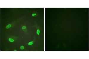 Immunofluorescence analysis of HeLa cells, using p53 (Acetyl-Lys379) Antibody. (p53 Antikörper  (acLys381))