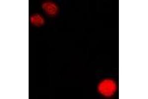 Immunofluorescent analysis of CLIC1 staining in Hela cells. (CLIC1 Antikörper)