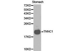 Western Blotting (WB) image for anti-Cardiac Troponin C (TNNC1) antibody (ABIN1875147)