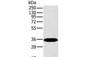 Western Blot analysis of Mouse brain tissue using PPP2CA Polyclonal Antibody at dilution of 1:450 (PPP2CA Antikörper)