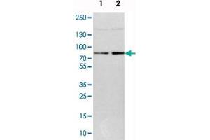 Western blot analysis of cell lysates with DNAJC14 polyclonal antibody  at 1:250-1:500 dilution. (DNAJC14 Antikörper)