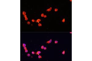 Immunofluorescence analysis of SH-SY5Y cells using CDK5R1 antibody (ABIN7266592) at dilution of 1:100. (CDK5R1 Antikörper  (AA 99-307))