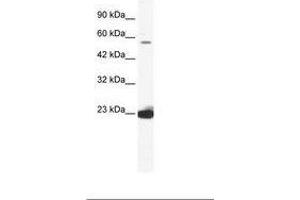 Image no. 1 for anti-DEAD (Asp-Glu-Ala-Asp) Box Polypeptide 55 (DDX55) (AA 468-517) antibody (ABIN202800) (DDX55 Antikörper  (AA 468-517))