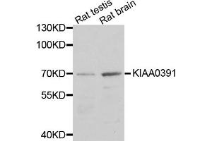 Western blot analysis of extracts of various cell lines, using KIAA0391 antibody (ABIN5971738) at 1/1000 dilution. (KIAA0391 Antikörper)