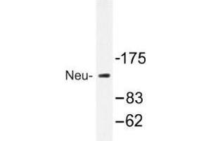 Image no. 1 for anti-Receptor tyrosine-protein kinase erbB-2 (ErbB2/Her2) antibody (ABIN317887) (ErbB2/Her2 Antikörper)