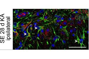 Immunostaining of mouse hippocampal CA1 region showing GFAP and IL1B labeling of astrocytes 28 days after KA-induced status epilepticus (SE).