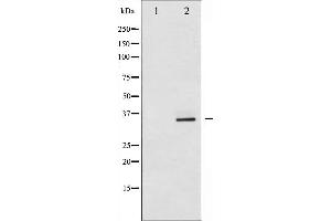 Western blot analysis of CDK2 expression in A2780 whole cell lysates,The lane on the left is treated with the antigen-specific peptide.