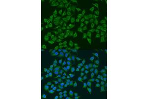 Immunofluorescence analysis of U2OS cells using iNOS antibody (ABIN6129509, ABIN6144728, ABIN6144730 and ABIN6218243) at dilution of 1:100. (NOS2 Antikörper  (AA 500-730))
