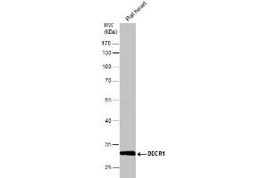 WB Image Rat tissue extract (50 μg) was separated by 10% SDS-PAGE, and the membrane was blotted with DECR1 antibody , diluted at 1:10000. (DECR1 Antikörper)