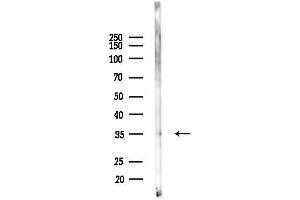anti-Peropsin (RRH) (Internal Region) antibody