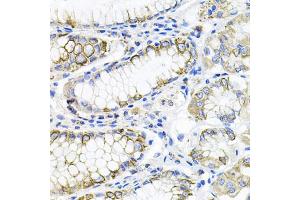 Immunohistochemistry of paraffin-embedded human stomach using ACVR2A antibody. (ACVR2A Antikörper)
