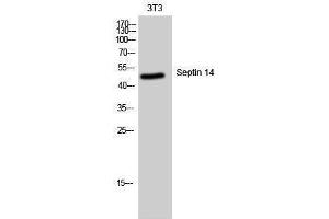 Western Blotting (WB) image for anti-Septin 14 (SEPT14) (C-Term) antibody (ABIN3180873) (Septin 14 Antikörper  (C-Term))
