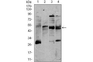 Western blot analysis using CD5 antibody against K562 (1), Jurkat (2), Raji (3), and MOLT4 (4) cell lysate. (CD5 Antikörper  (AA 27-233))