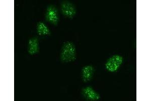 IF analysis of KIFC1 using anti-KIFC1 antibody (ABIN7599523). (KIFC1 Antikörper  (AA 1-673))