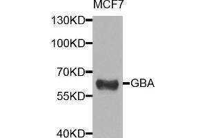 Western blot analysis of extracts of MCF-7 cells, using GBA antibody (ABIN5974589) at 1/1000 dilution. (GBA Antikörper)