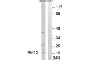 Western Blotting (WB) image for anti-Mitochondrial Ribosomal Protein L12 (MRPL12) (AA 31-80) antibody (ABIN2890047) (MRPL12 Antikörper  (AA 31-80))