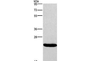 Western Blot analysis of Riji cell using IFNA16 Polyclonal Antibody at dilution of 1:400 (IFNA16 Antikörper)