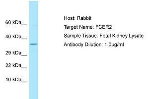 Host: Rabbit Target Name: FCER2 Sample Type: Fetal Kidney lysates Antibody Dilution: 1. (FCER2 Antikörper  (C-Term))