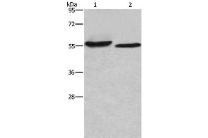 Western Blot analysis of SP20 cell and Mouse heart tissue using AMIGO2 Polyclonal Antibody at dilution of 1:615 (AMIGO2 Antikörper)
