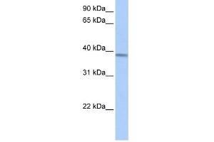 ACADSB antibody used at 1 ug/ml to detect target protein. (ACADSB Antikörper  (Middle Region))