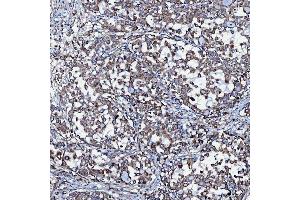 IHC analysis of SEC23IP using anti-SEC23IP antibody (ABIN7601222). (SEC23IP Antikörper  (AA 30-426))