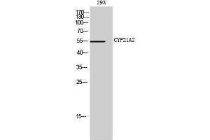 Western Blotting (WB) image for anti-Cytochrome P450, Family 21, Subfamily A, Polypeptide 2 (CYP21A2) (Internal Region) antibody (ABIN3184164) (CYP21A2 Antikörper  (Internal Region))