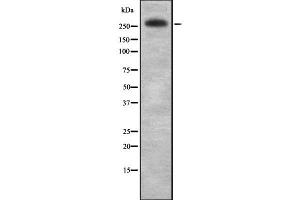 Western blot analysis IGF2R using Jurkat whole cell lysates (IGF2R Antikörper  (C-Term))