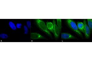 Immunocytochemistry/Immunofluorescence analysis using Mouse Anti-GRP78 Monoclonal Antibody, Clone 1H11-1H7 (ABIN863112). (GRP78 Antikörper)