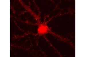 Indirect immunostaining of PFA fixed cultured rat hippocampus neurons (dilution 1 : 500). (Alpha, beta Synuclein Antikörper)
