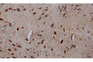 Immunohistochemistry of paraffin-embedded Human brain tissue using PIK3CB Polyclonal Antibody at dilution 1:50 (PIK3CB Antikörper)