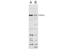 Western Blotting (WB) image for anti-SECIS Binding Protein 2 (SECISBP2) (Internal Region) antibody (ABIN2466241)