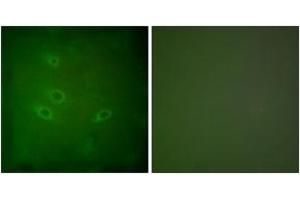 Immunofluorescence analysis of HeLa cells, using CARD6 Antibody. (CARD6 Antikörper  (AA 1-50))