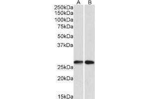 Western Blotting (WB) image for anti-Nicotinamide N-Methyltransferase (NNMT) antibody (ABIN5903827) (NNMT Antikörper)