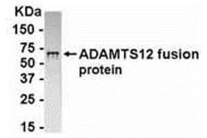 Western Blotting (WB) image for anti-ADAM Metallopeptidase with thrombospondin Type 1 Motif, 12 (ADAMTS12) (AA 297-446) antibody (ABIN2468193)