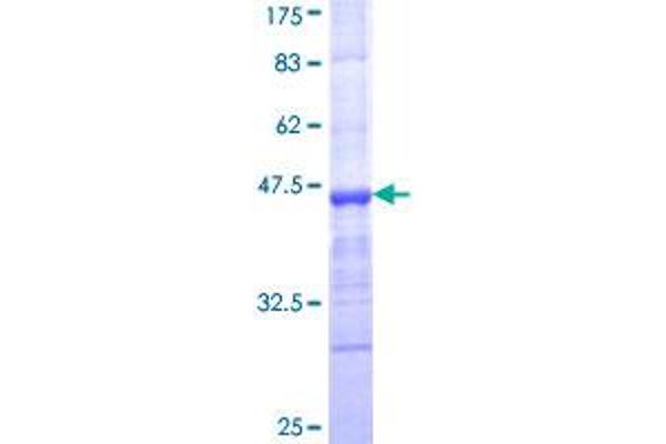 Multimerin 1 Protein (MMRN1) (AA 291-390) (GST tag)