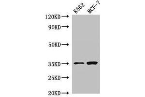 Western Blot Positive WB detected in: K562 whole cell lysate, MCF-7 whole cell lysate All lanes: EN2 antibody at 2. (EN2 Antikörper  (AA 1-251))