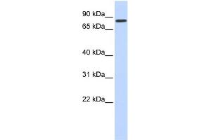 WB Suggested Anti-AMOT Antibody Titration:  0. (Angiomotin Antikörper  (N-Term))