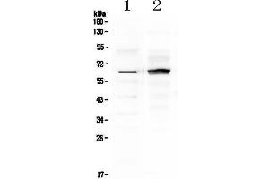 Western blot analysis of Frizzled 4 using anti-Frizzled 4 antibody . (FZD4 Antikörper)