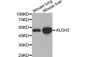 Western blot analysis of extracts of various cell lines, using ALDH2 antibody (ABIN5970568) at 1/1000 dilution.