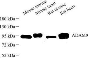 Western blot analysis of ADAM9 (ABIN7072943) at dilution of 1: 500